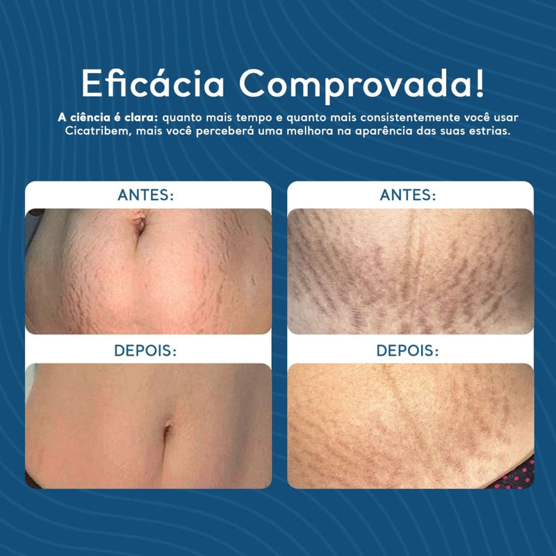 Creme Antiestrias Regenerador Dérmico